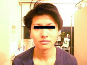 矯正1回目